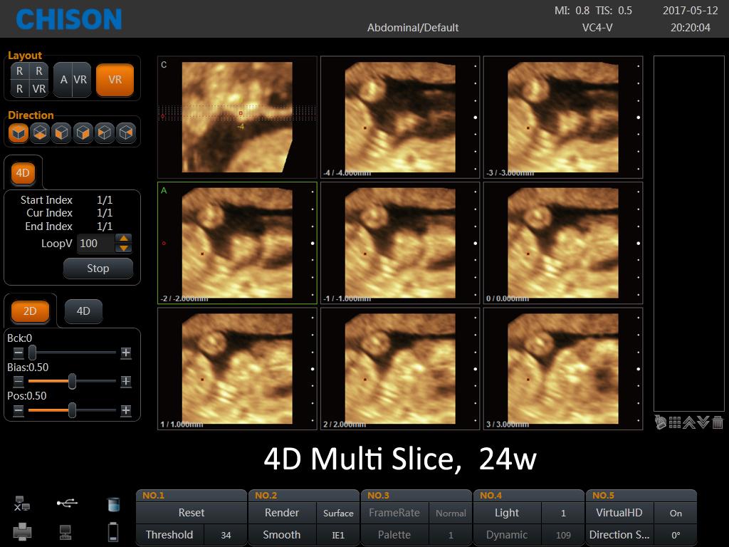 SonoBook multislice 4D